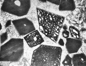 M,58y. | crystalline inclusions in hepatocyte after unknown medication M,58y. | crystalline inclusions in hepatocyte after unknown medication